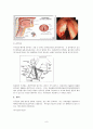 후두암(larynx cancer)수술 9페이지