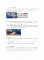 비중격만곡증(Nasal septal deviation)과 수술적 치료 13페이지