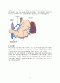 위암(Stomach cancer)과 위절제술(Gastrectomy) 7페이지