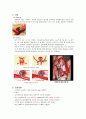 [신경외과] SAH(Subarachnoid hemorrhage) 지주막하출혈 2페이지