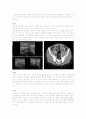 충수염(appendicitis) 케이스 2페이지