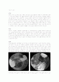 위궤양(gastric ulcer) 케이스 2페이지