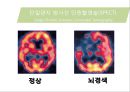 뇌혈관질환(뇌졸중) (Cerebrovascular disease).ppt 29페이지