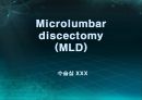 미세현미경 디스크제거술(Micro lumbar discectomy)PPT 1페이지