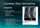 미세현미경 디스크제거술(Micro lumbar discectomy)PPT 6페이지