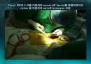 미세현미경 디스크제거술(Micro lumbar discectomy)PPT 37페이지