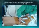 미세현미경 디스크제거술(Micro lumbar discectomy)PPT 38페이지