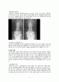 성인 골관절염간호과정 - 골관절염과 슬관절 케이스 스터디 (CASE STUDY ABOUT OSTEOARTHRITIS AND TOTAL KNEE REPLACEMENT) 4페이지