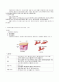 경막하출혈 문헌고찰 4페이지