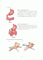 [간호학 case study] 간호실습, 위암, AGC : Advanced gastric cancer, 간호학 7페이지