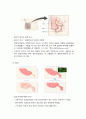 급성충수돌기염(acute appendicitis) 문헌고찰 A+++++ 2페이지