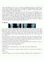 TKR(total knee replacement) 슬관절 치환술 2페이지