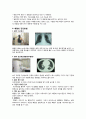 Pneumonia 폐렴케이스 스터디(폐렴케이스, 폐렴간호과정, 폐렴, 폐렴 사례연구, 폐렴실습, 내과실습 케이스) 7페이지
