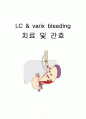 LC & varix bleeding 치료 및 간호 1페이지