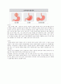 ER 흑색변 상부위장관 출혈 case 2페이지