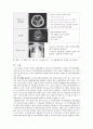 [동서협진과 CASE] 만성적인 설사를 주소로 하는 수두증 환자 1례 2페이지
