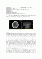 [동서협진과 CASE] 잦은 뇌졸중으로 인한 뇌경색 후유증 환자 1례 2페이지