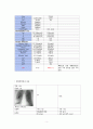 [아동간호학 실습] Case Study pneumonia unspecified Asthma unspecified 4페이지