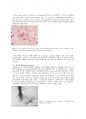 생화학 과제 - 단백질과 질병의 상관관계 4페이지